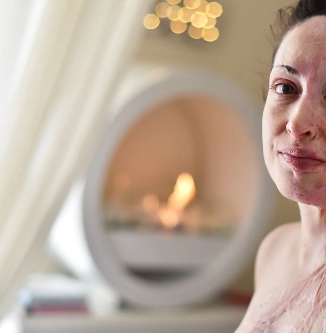 Ιωάννα Παλιοσπύρου: Σοκάρουν οι εικόνες από το νοσοκομείο – Συγκλονίζουν τα λόγια για την επίθεση #video